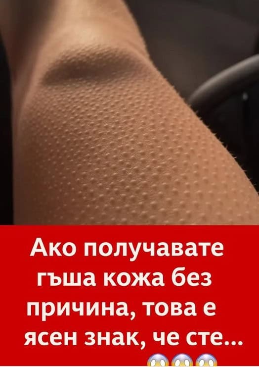 настръхнал крак